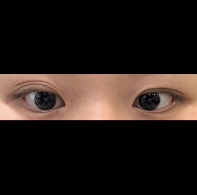 後