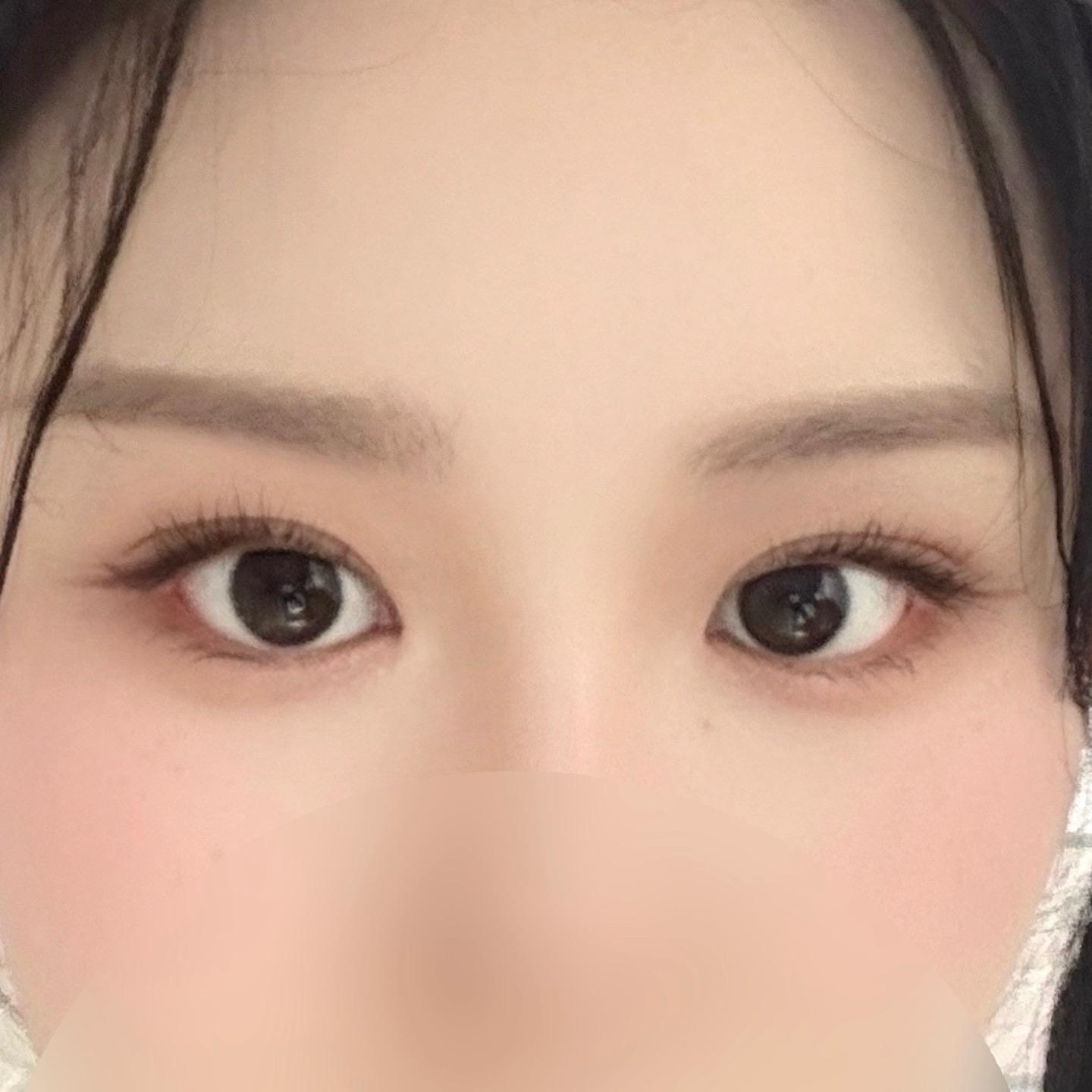 後