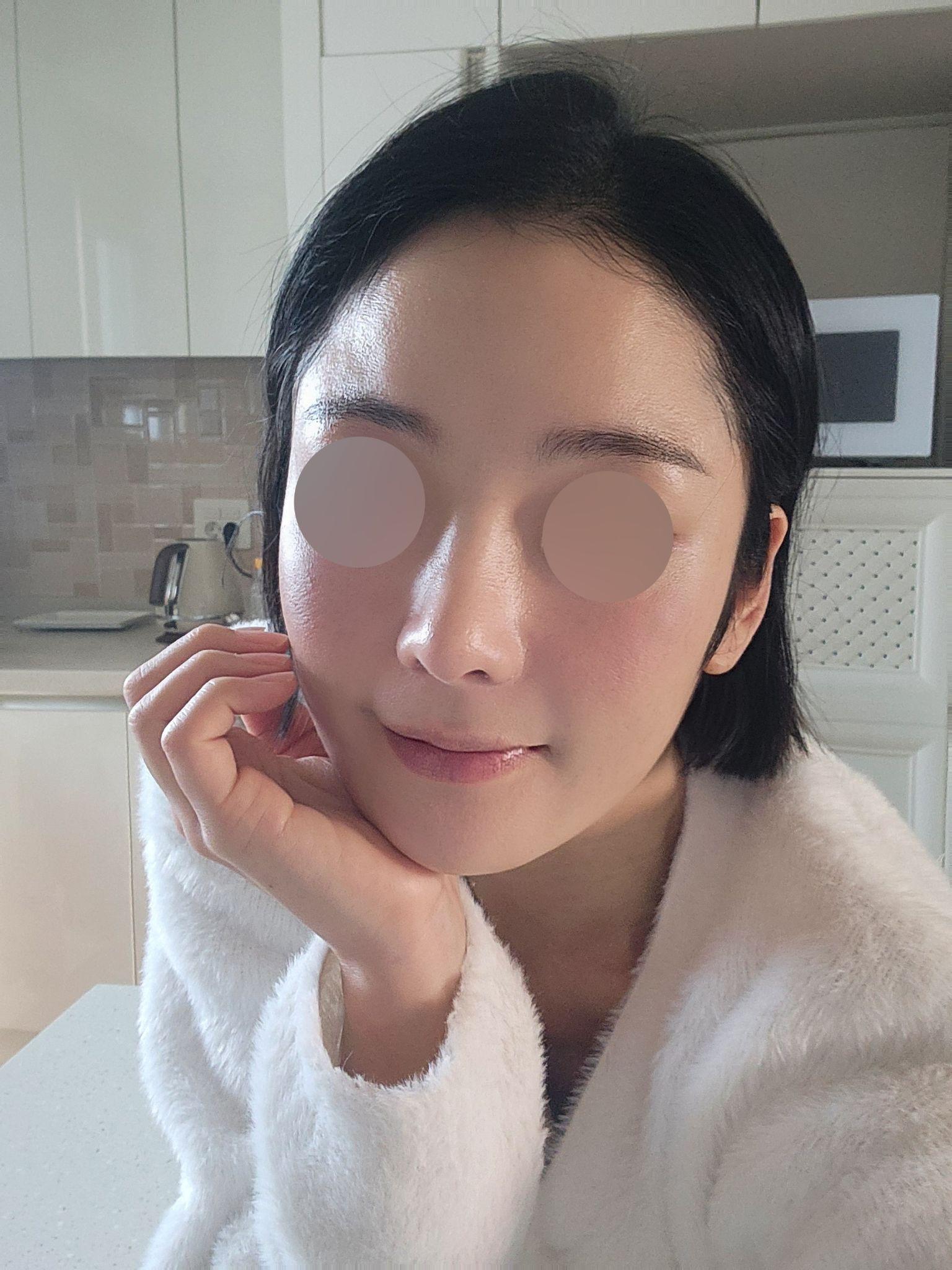 後