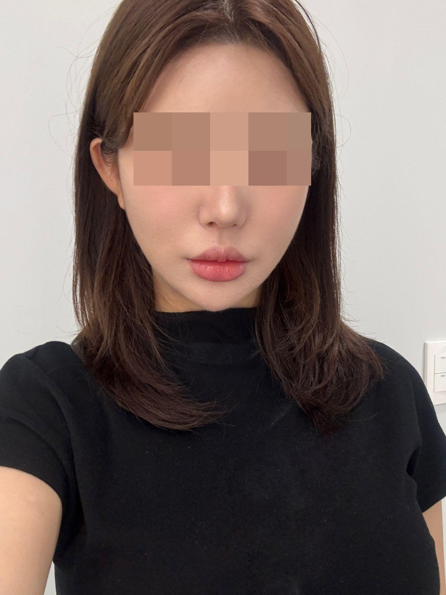 後