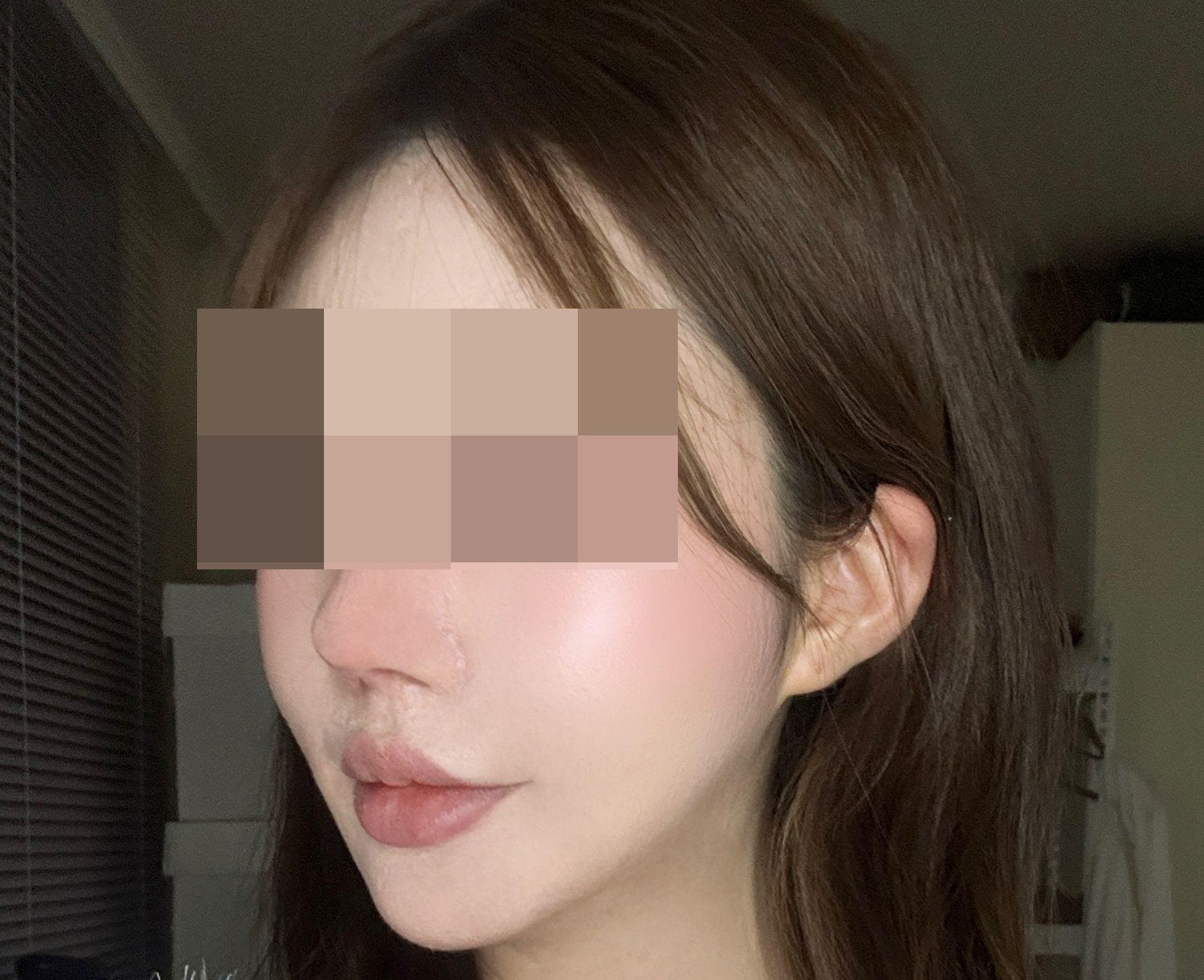 後