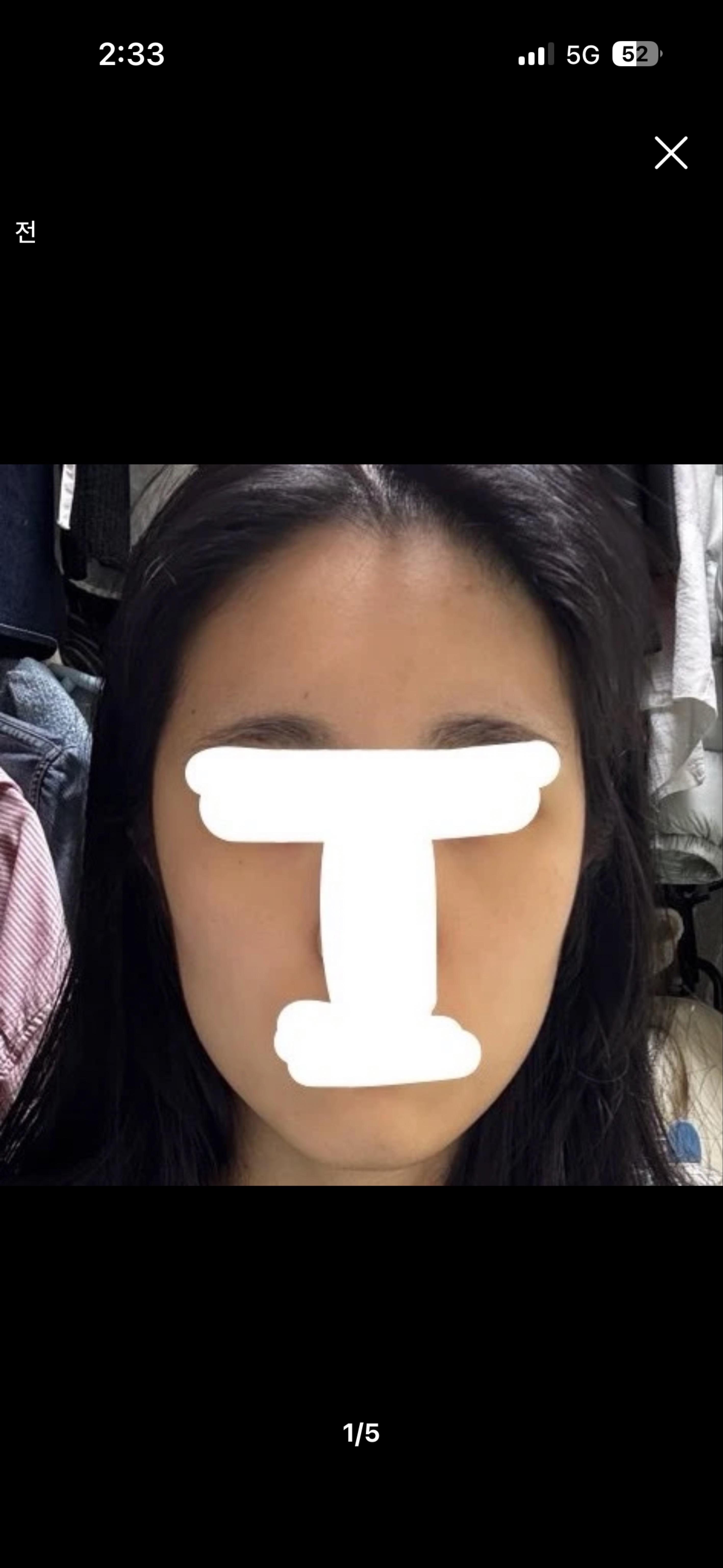 後