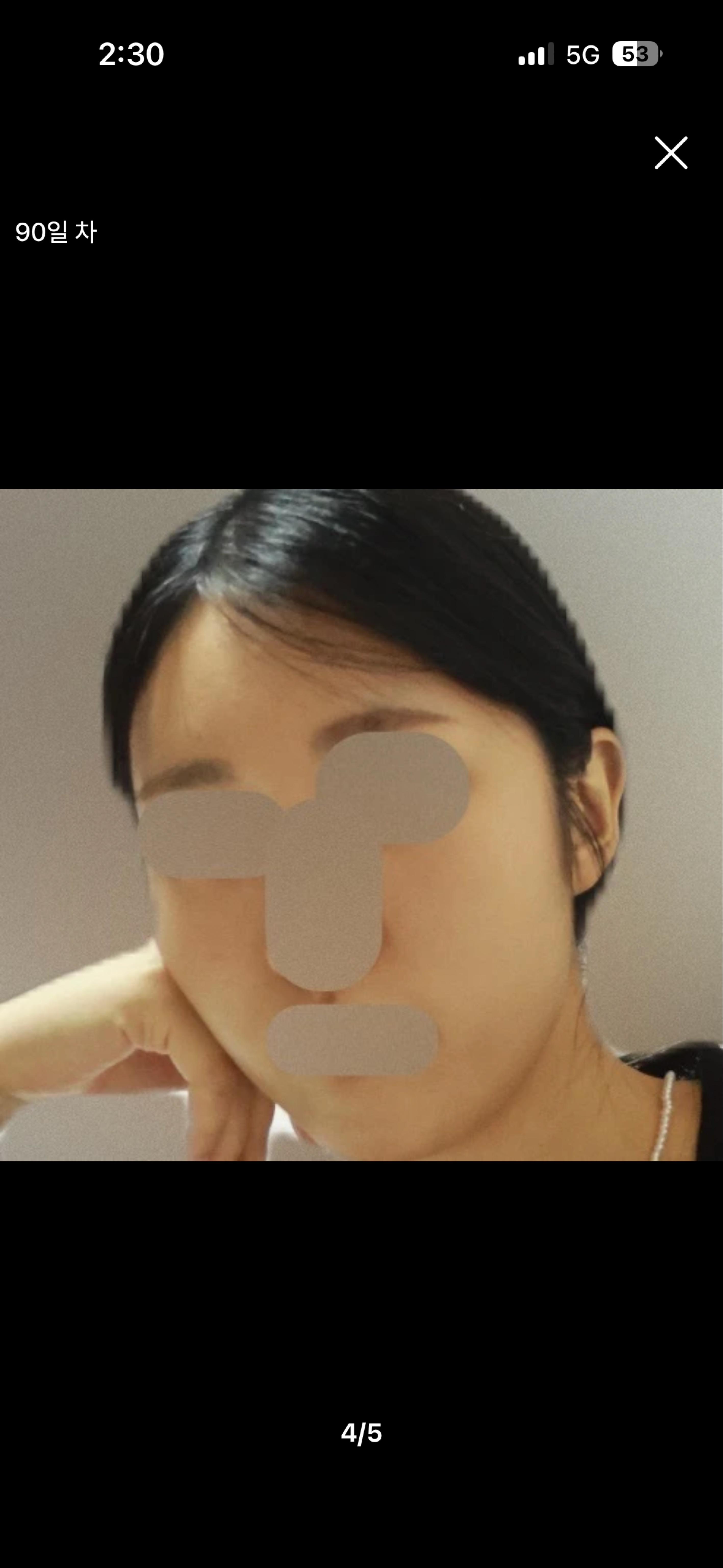 後