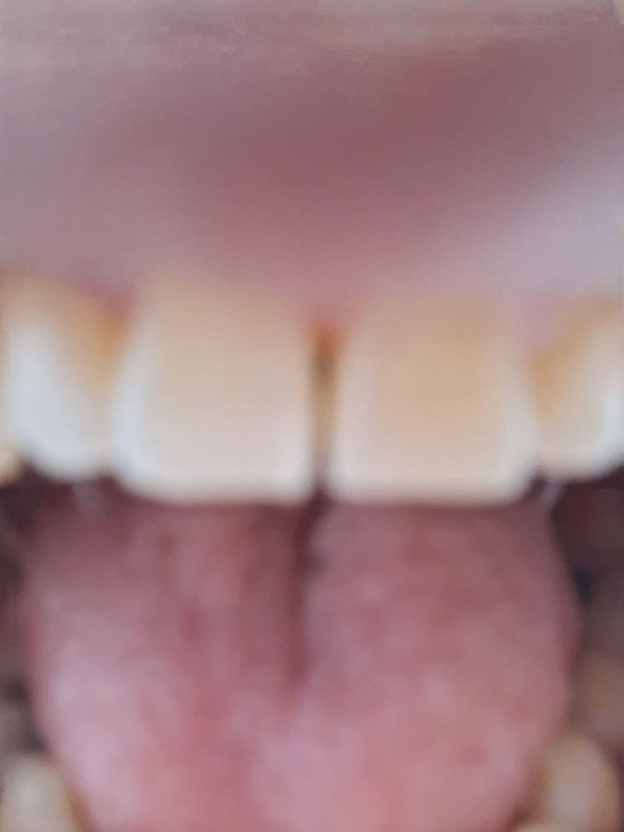後