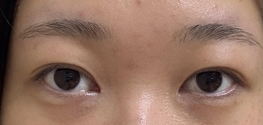 後