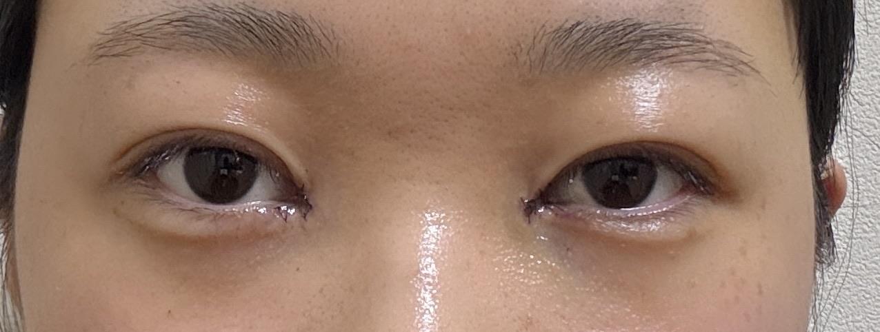 後