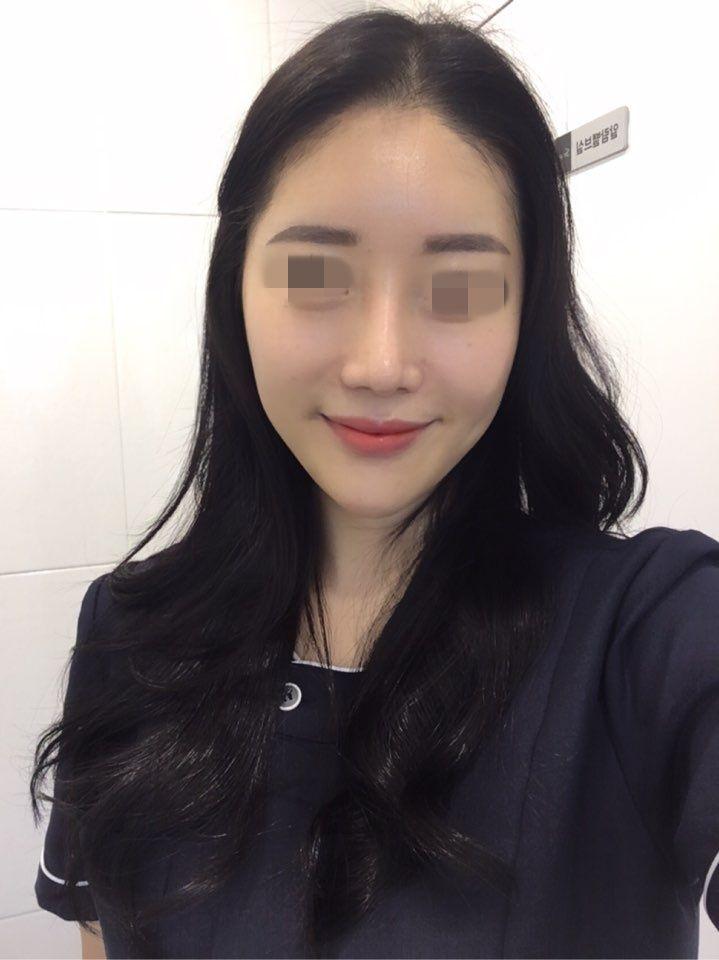 後