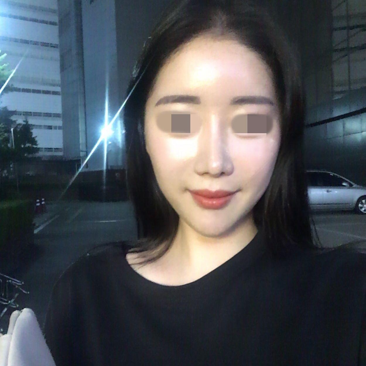 後