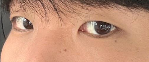 後