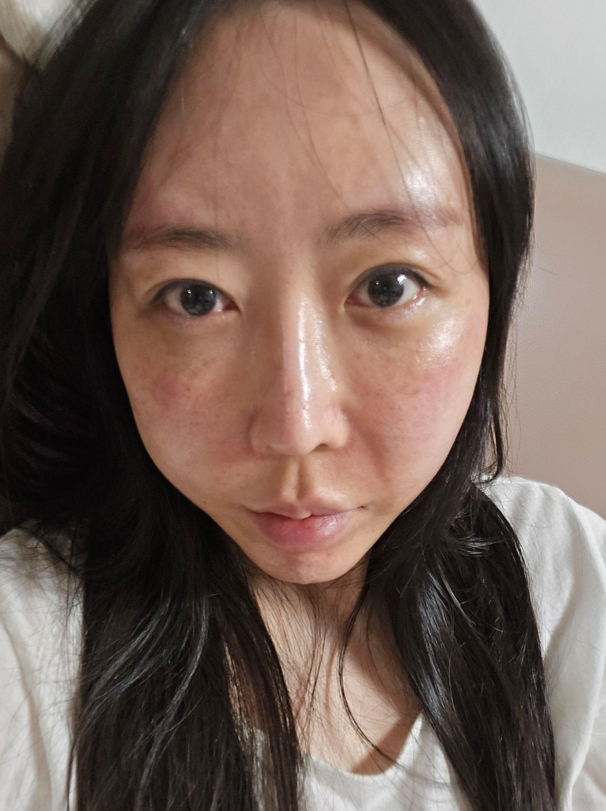 後