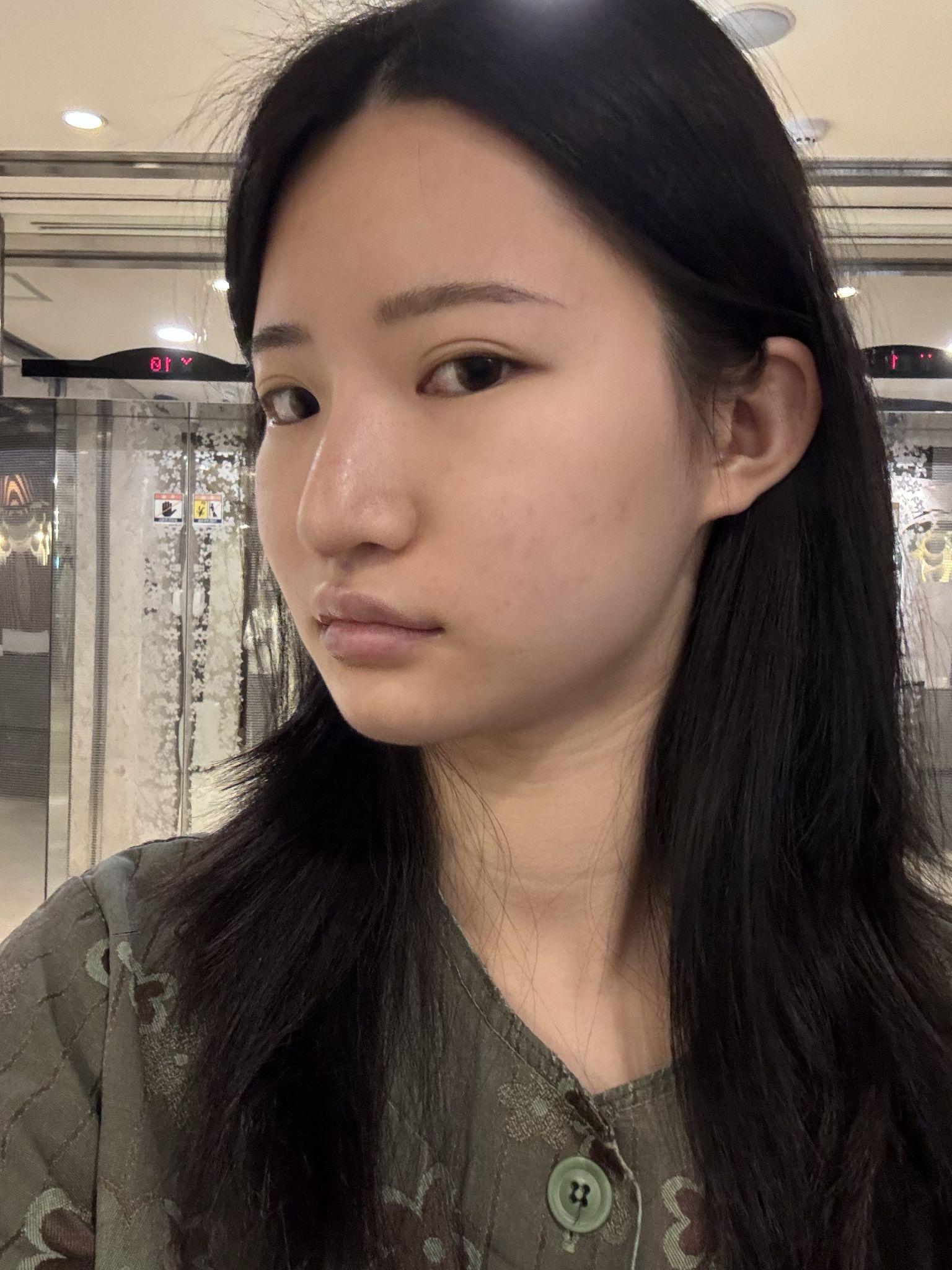 後