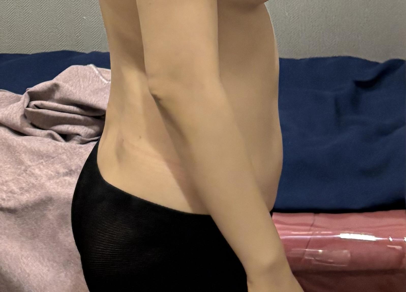 後