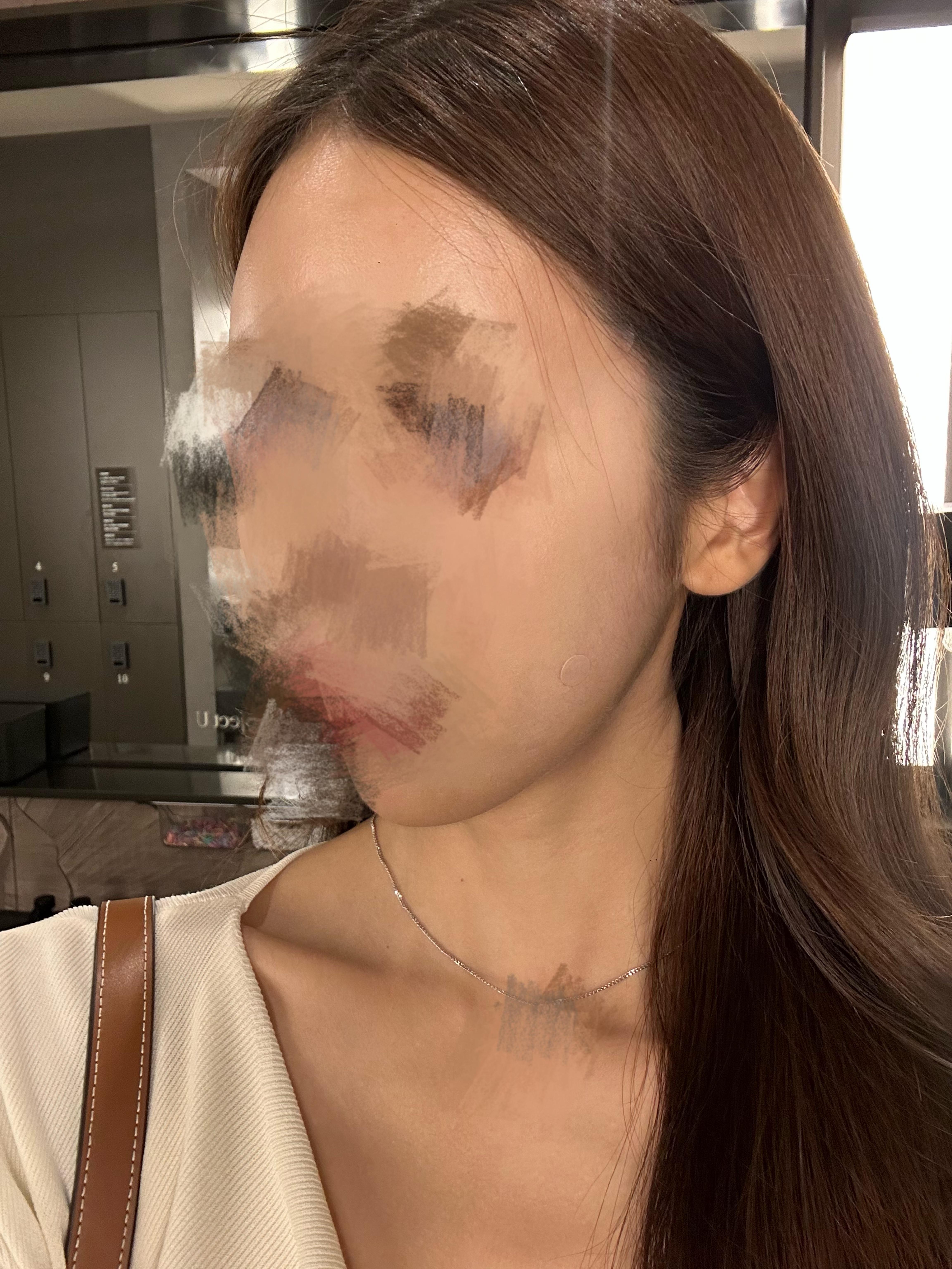 後