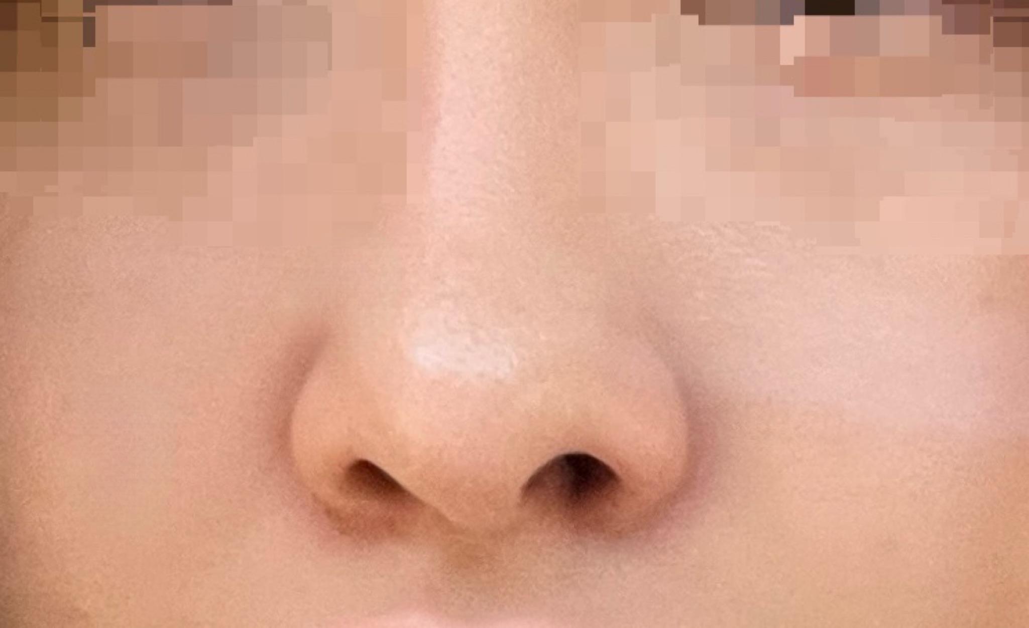 後