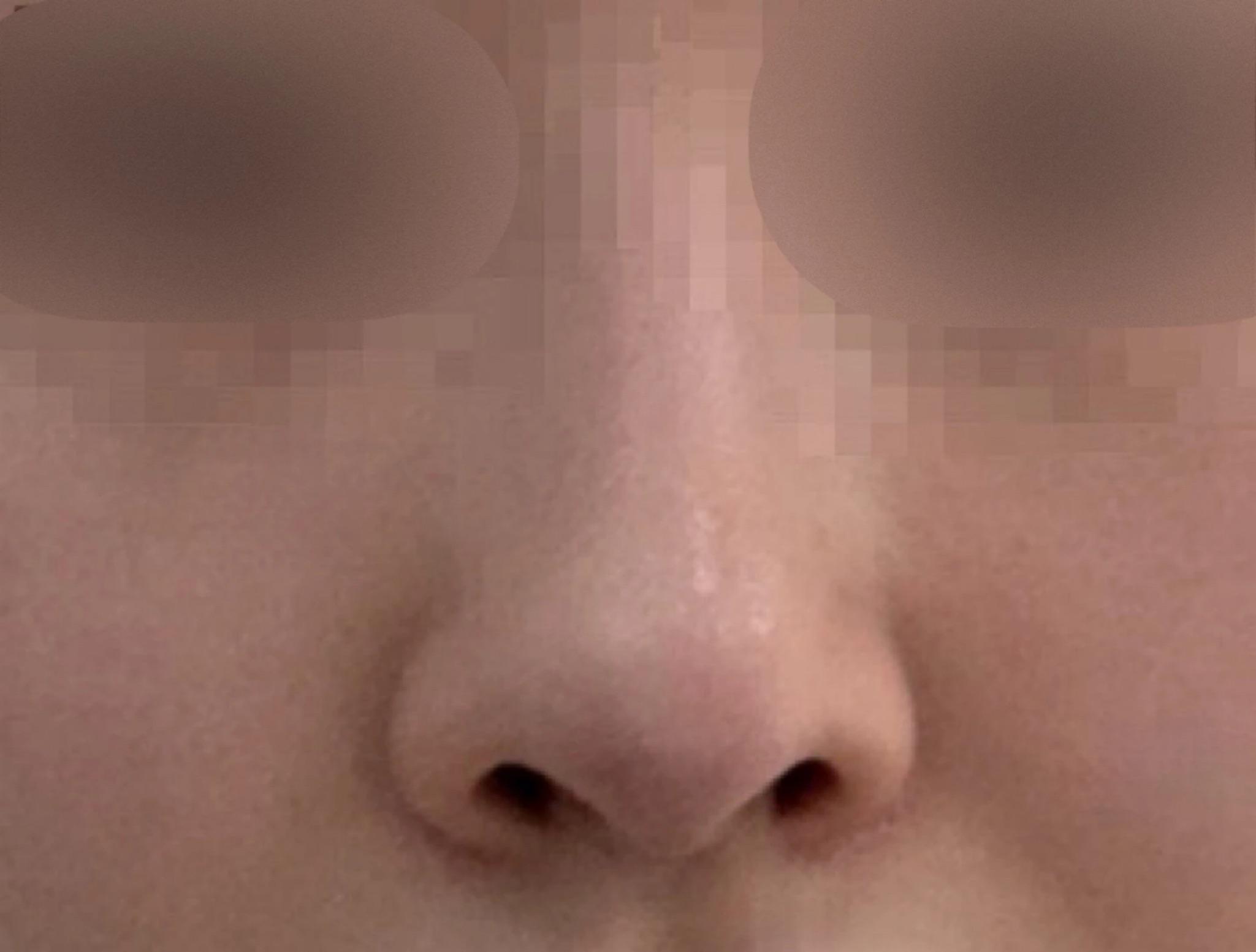 後