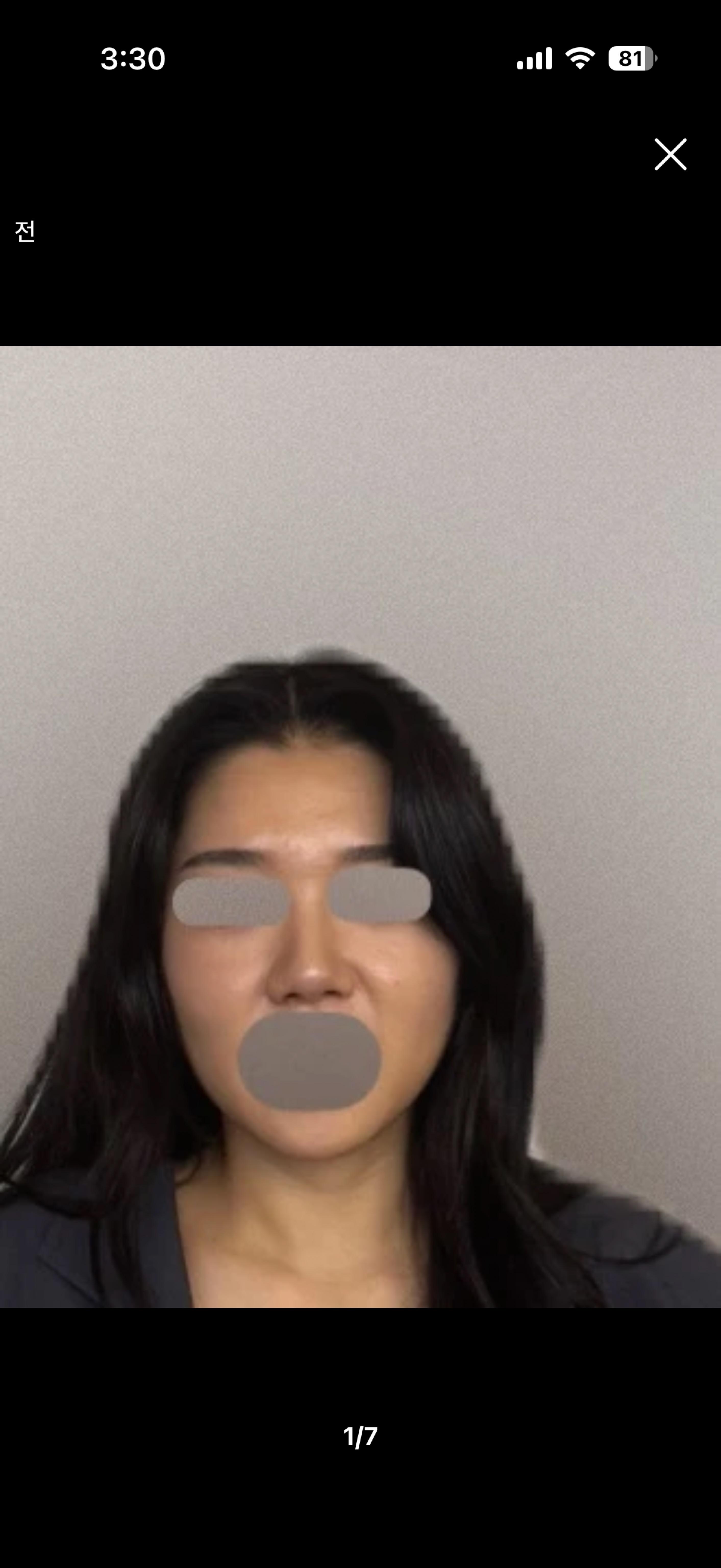 後