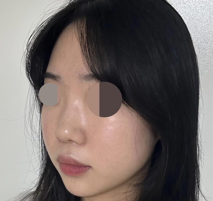 後