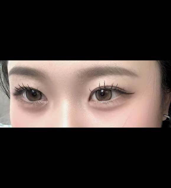 後