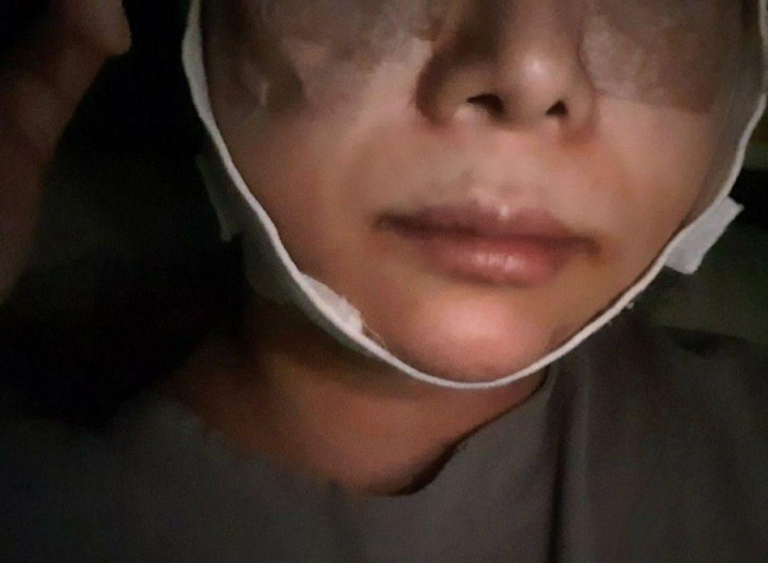 後