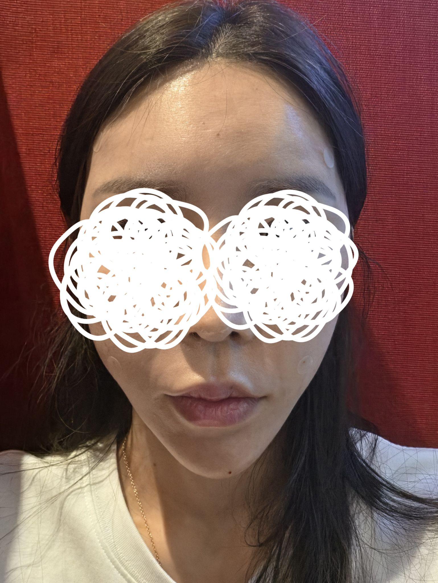 後