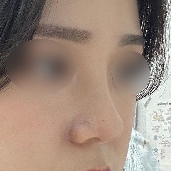 后