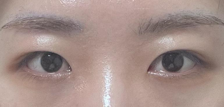 後