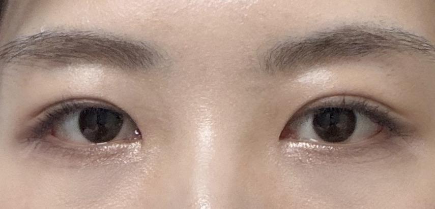 後