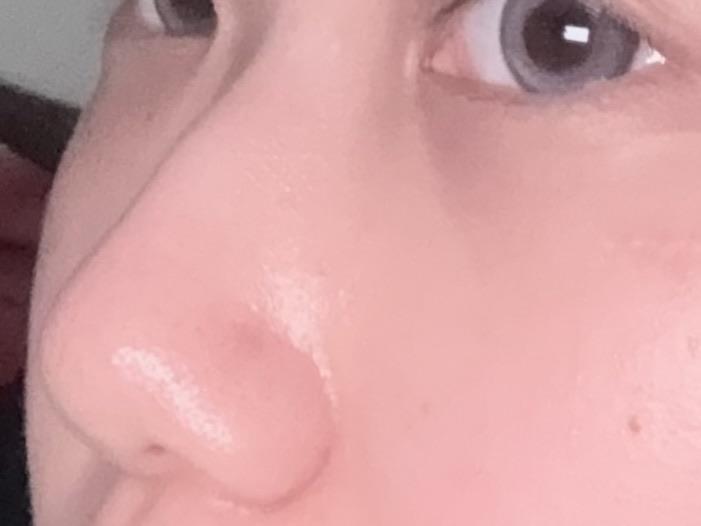 後