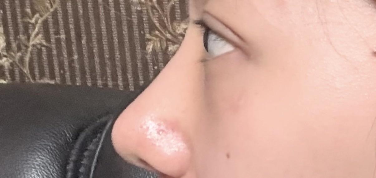 後