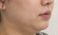 後