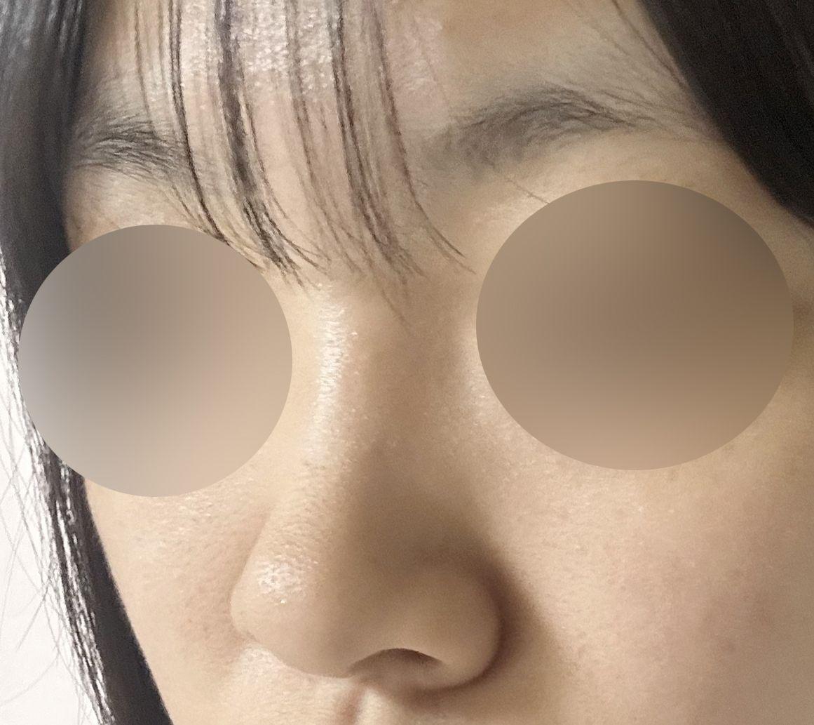 後