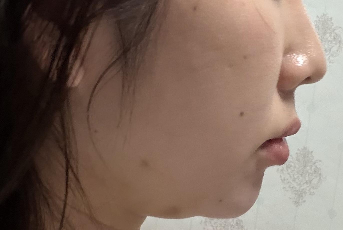 後