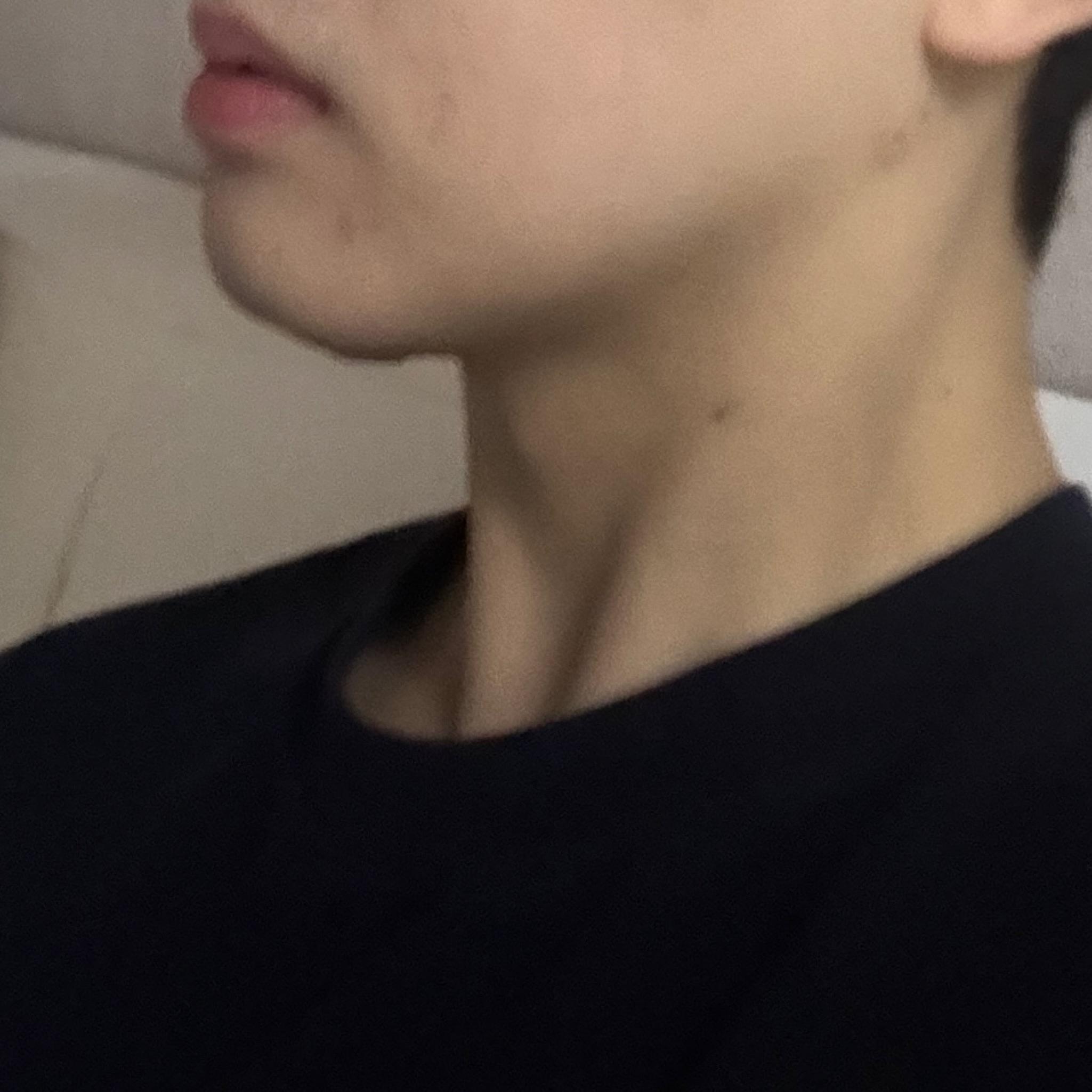 後