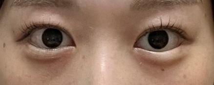 後
