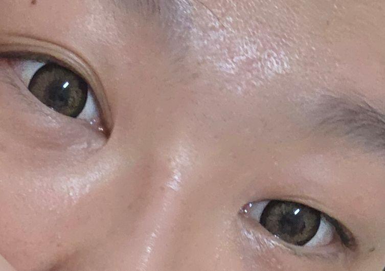 後