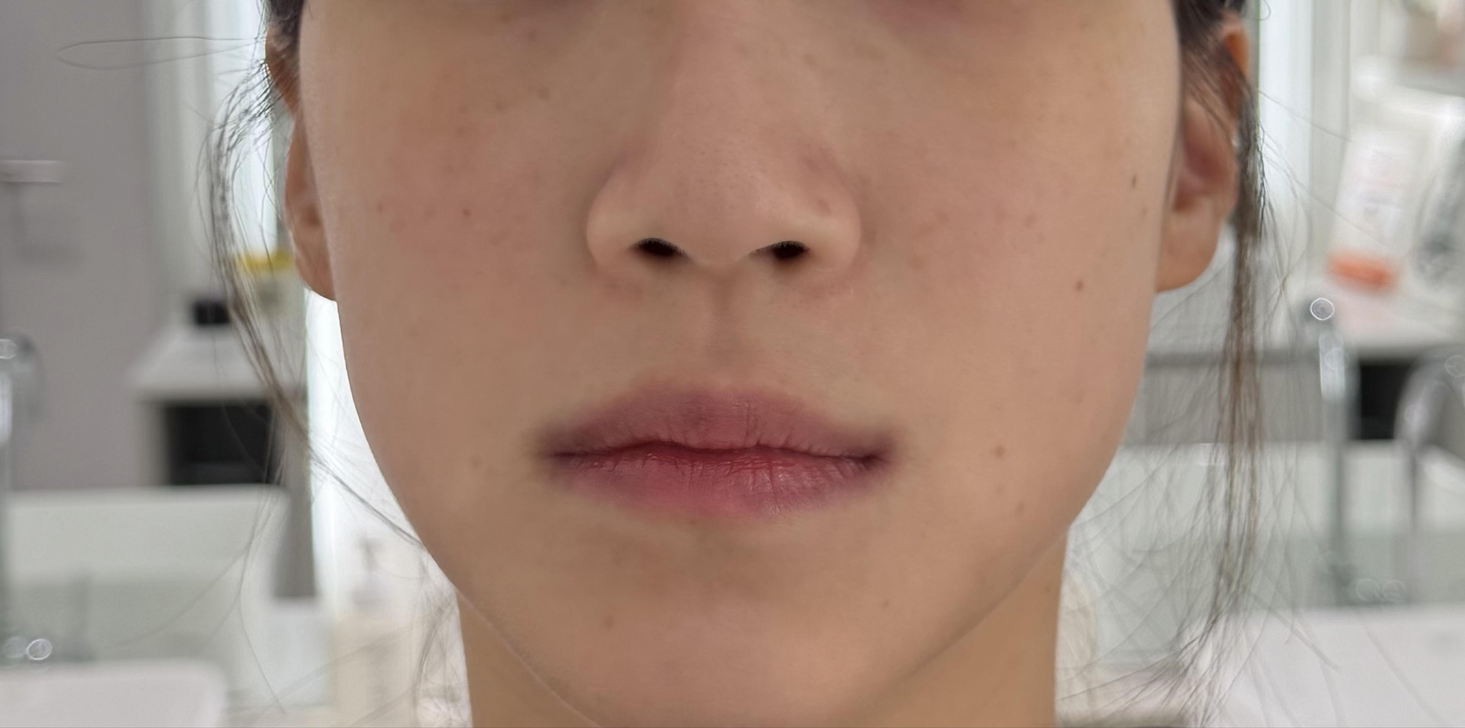 后