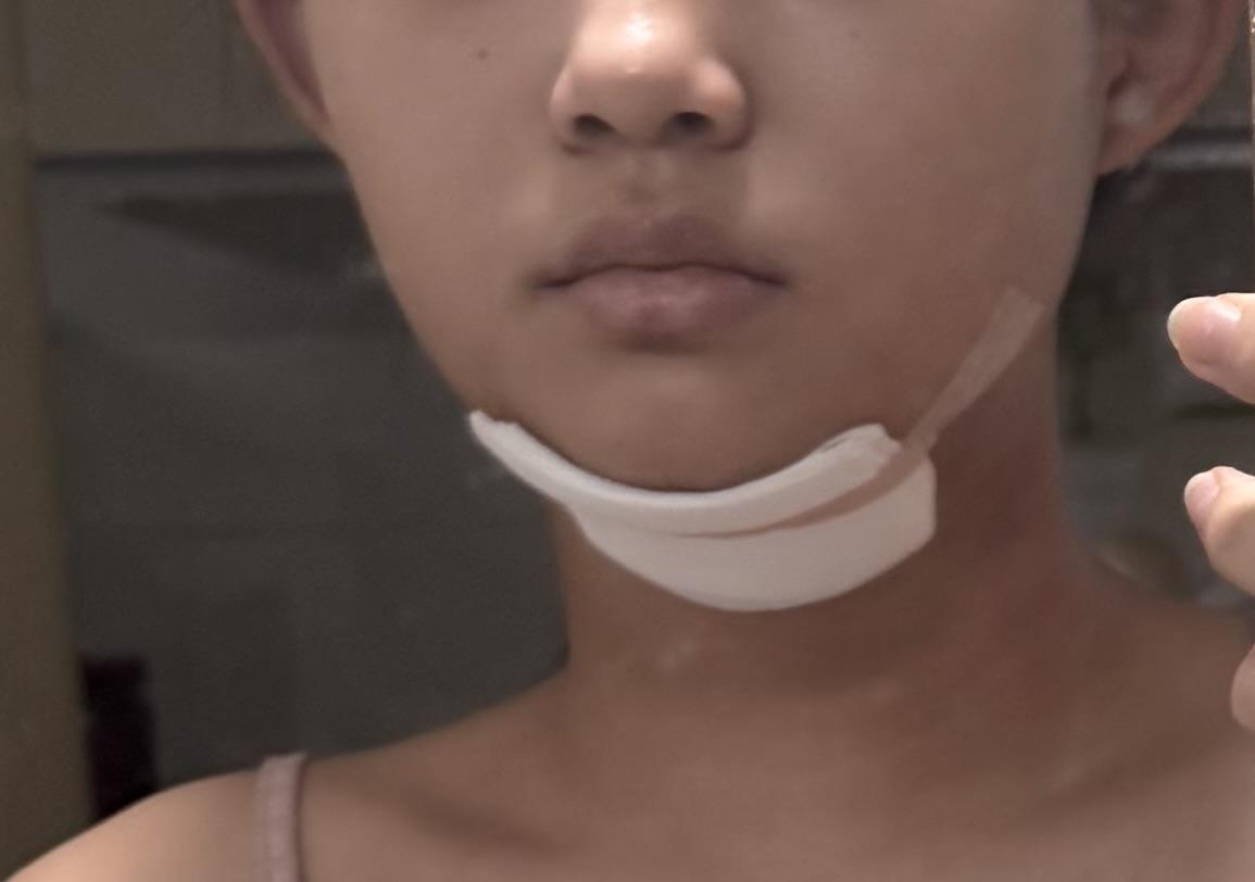 後