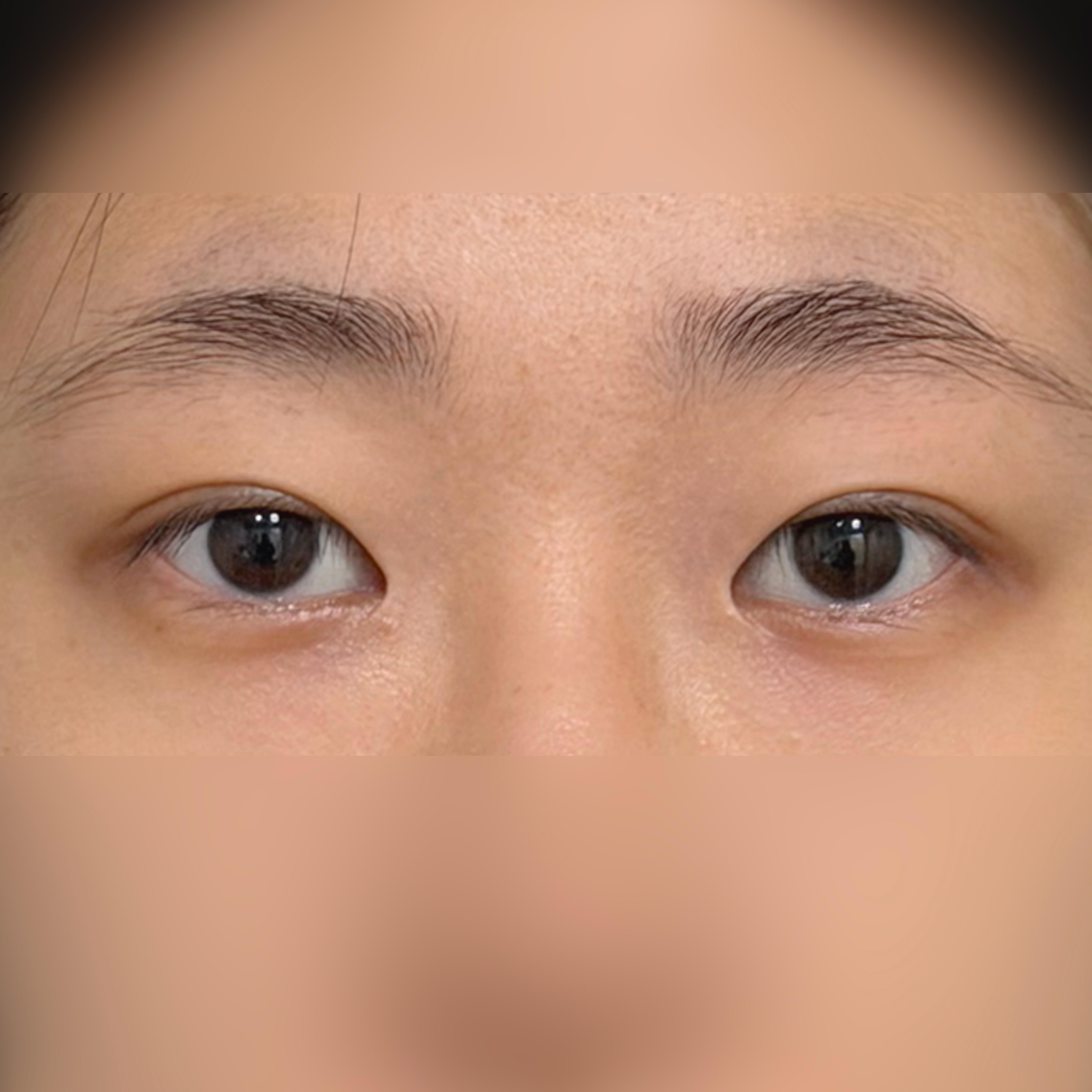 Before