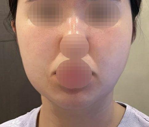 前