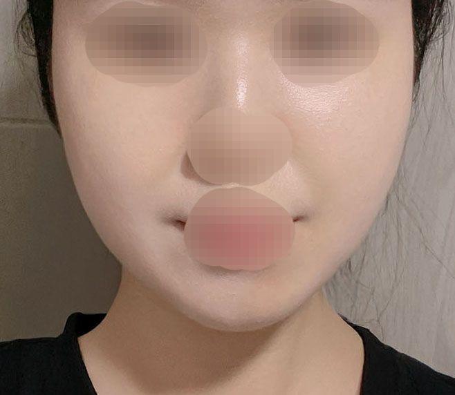后