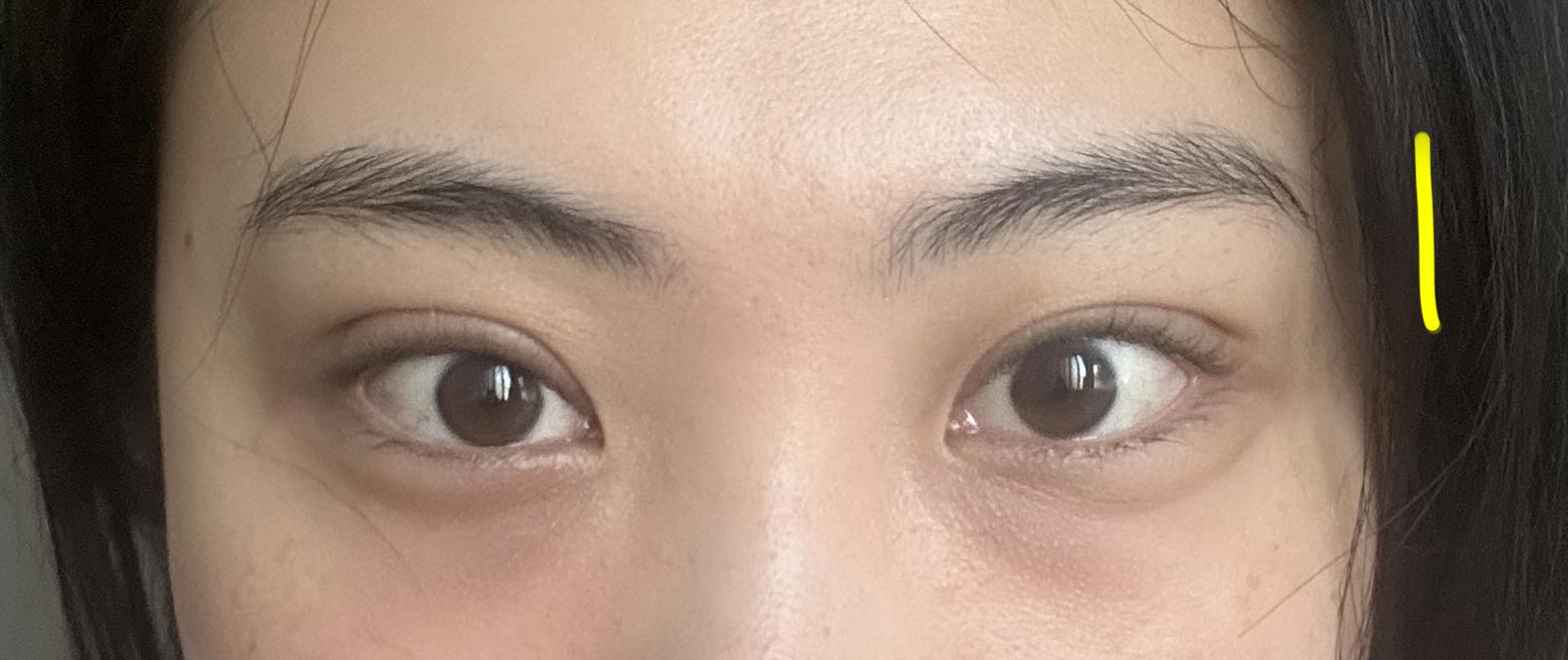 后