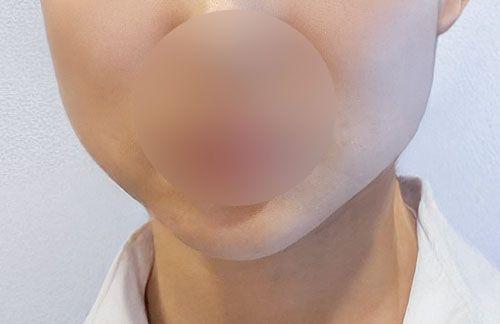 後