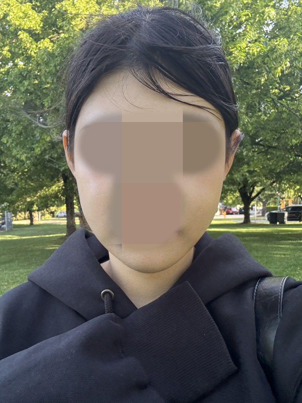 後