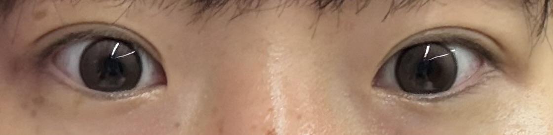 后