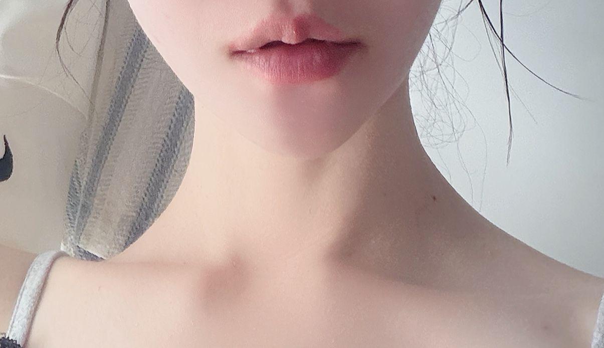 後