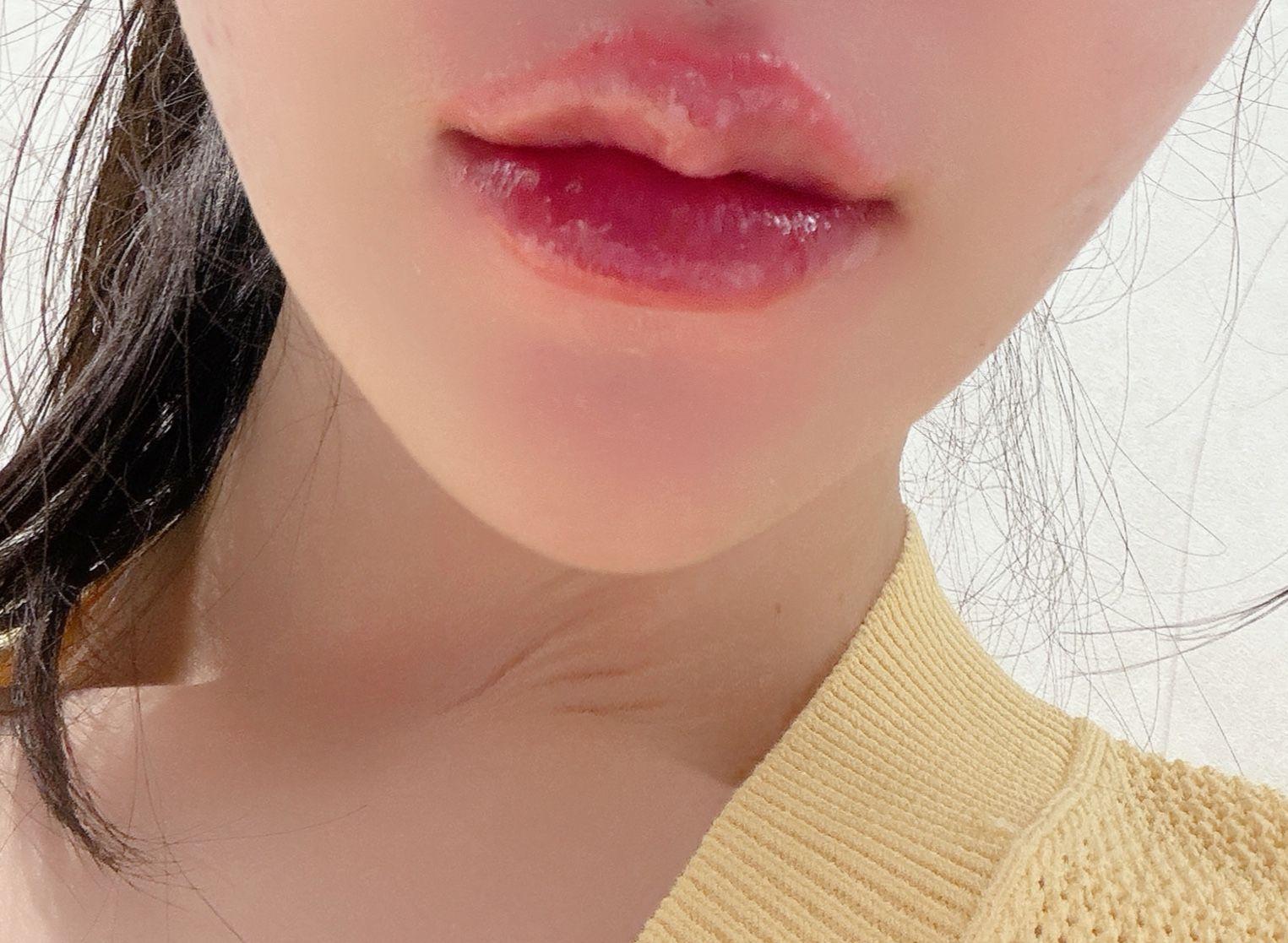 後