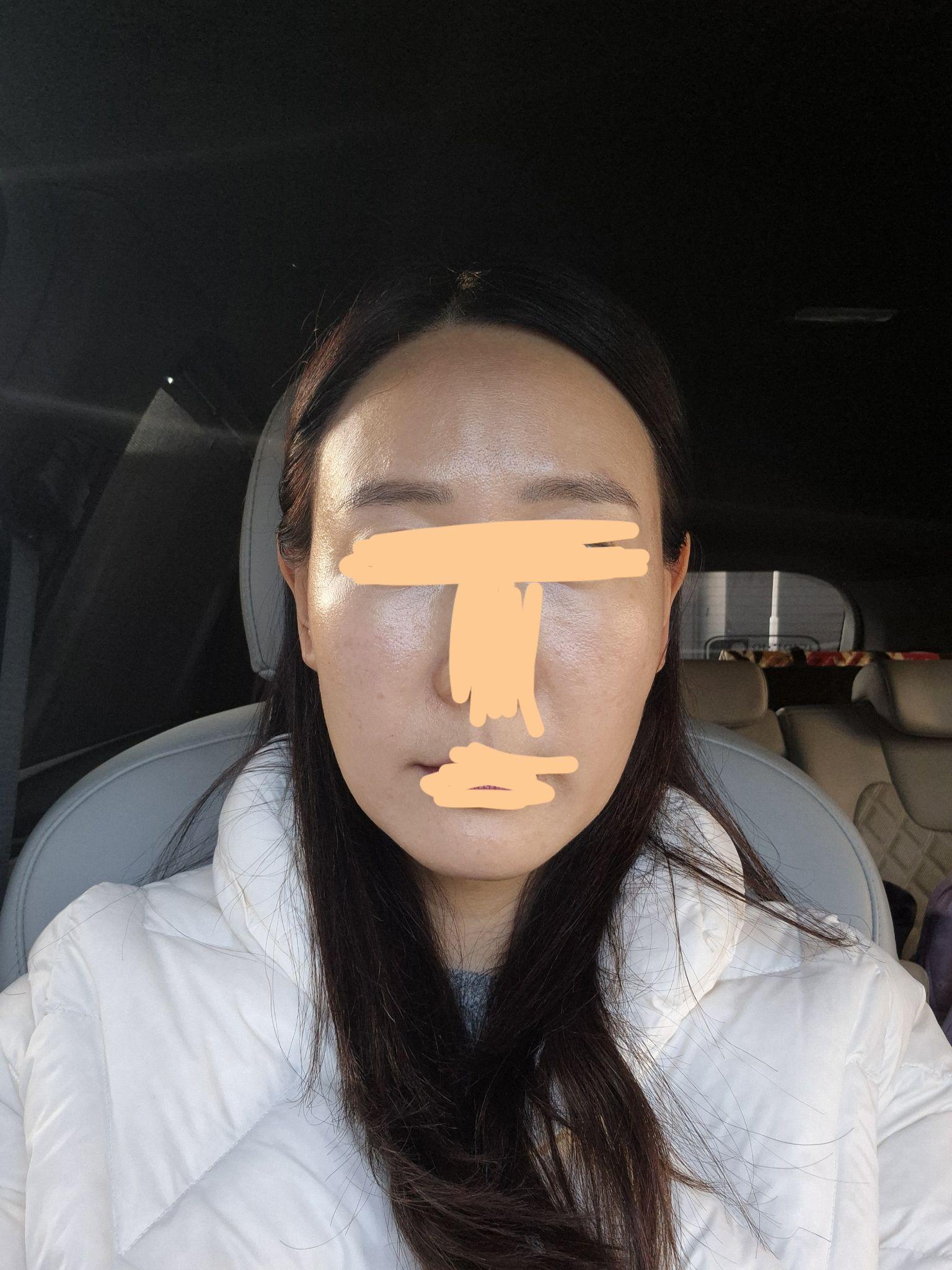 後