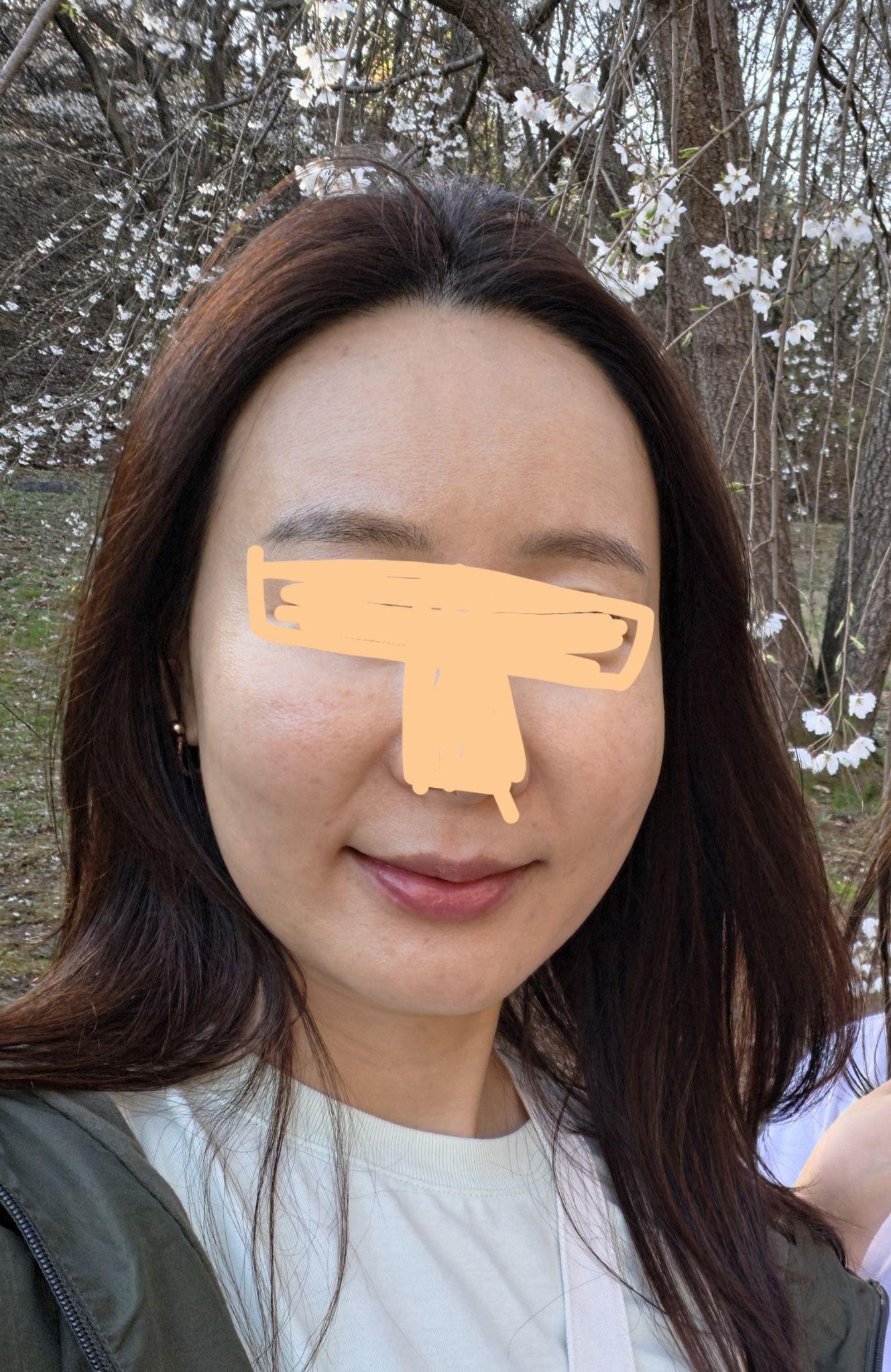後