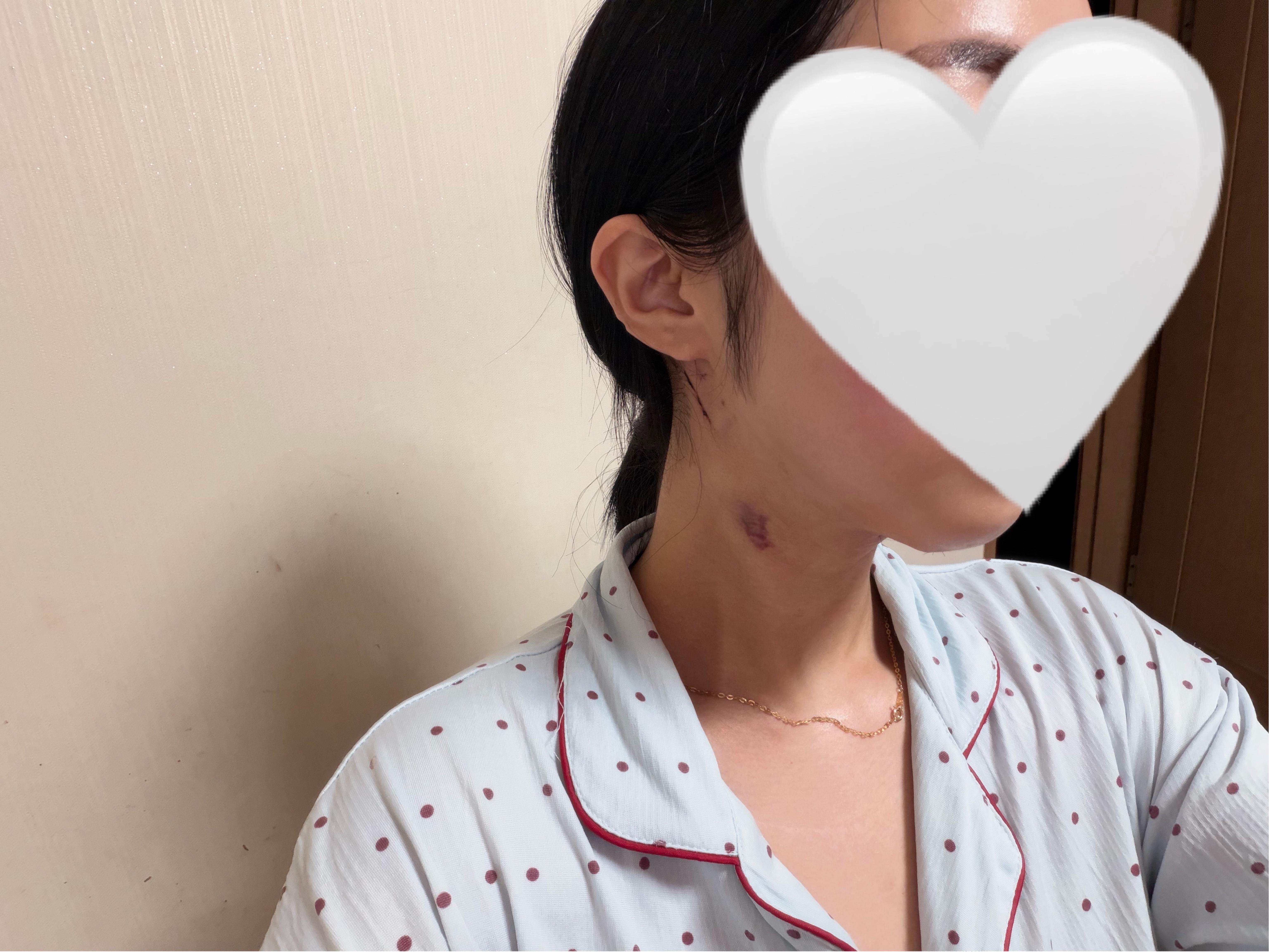後