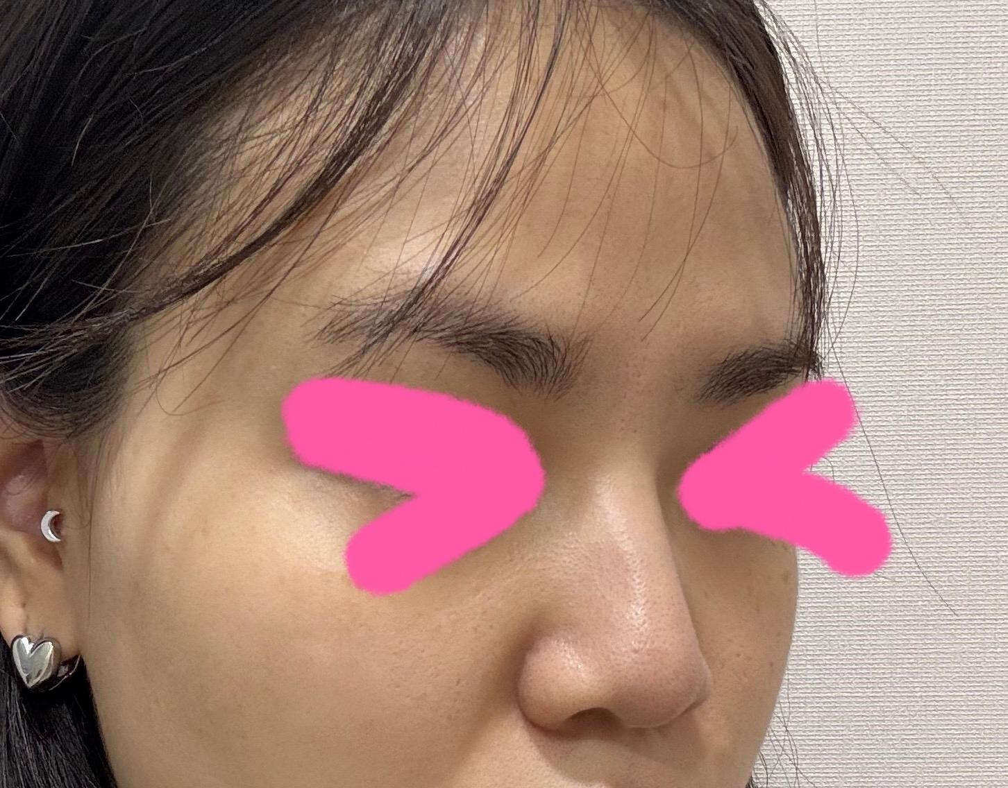 後